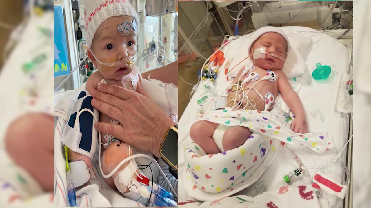 Community helping two boys battling a rare congenital heart condition ...
