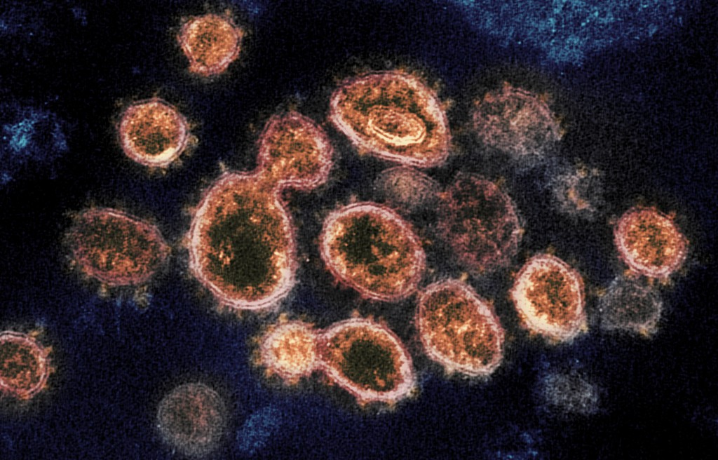 Coronavirus Novavax Vacuna