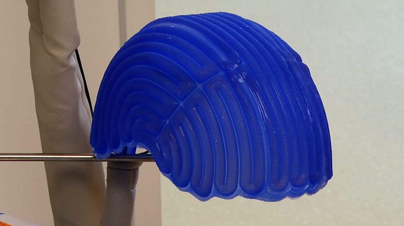 New Scalp Cooling Treatment Helps Reduce Hair Loss For Patients new-scalp-cooling-treatment-helps-reduce-hair-loss-for-patients