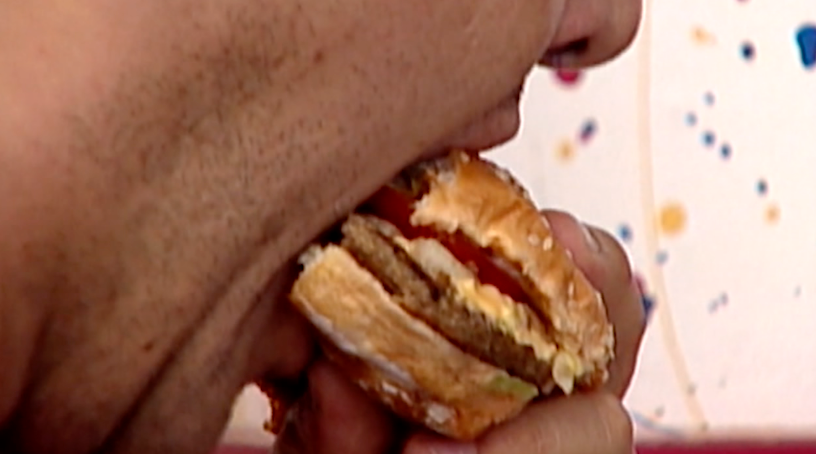 Obesity