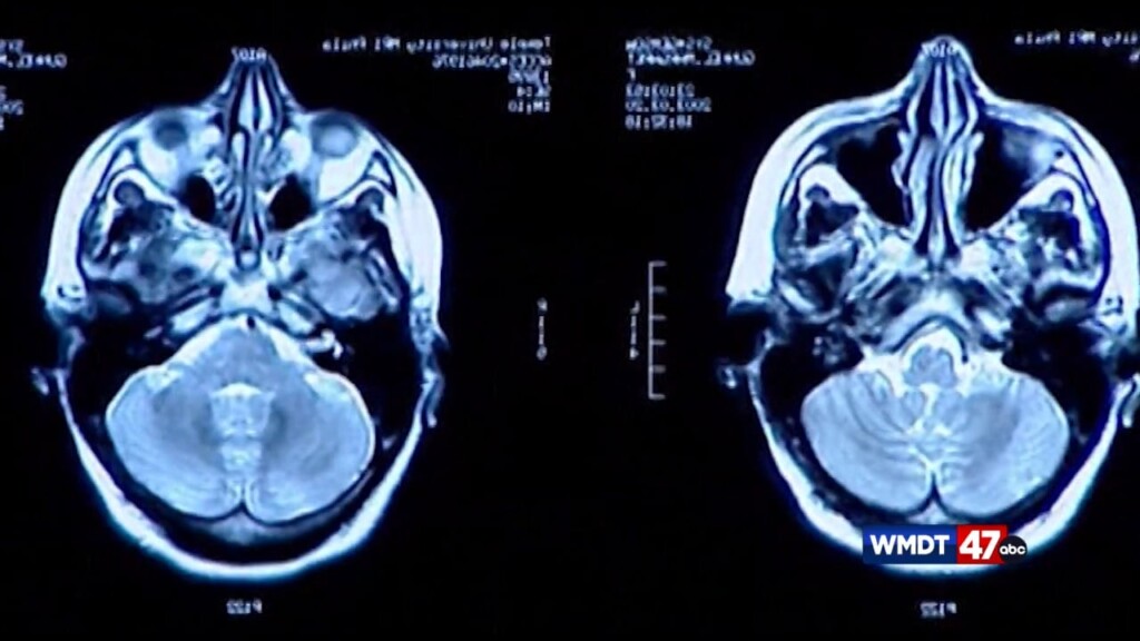 Winter Sports Brain Injury