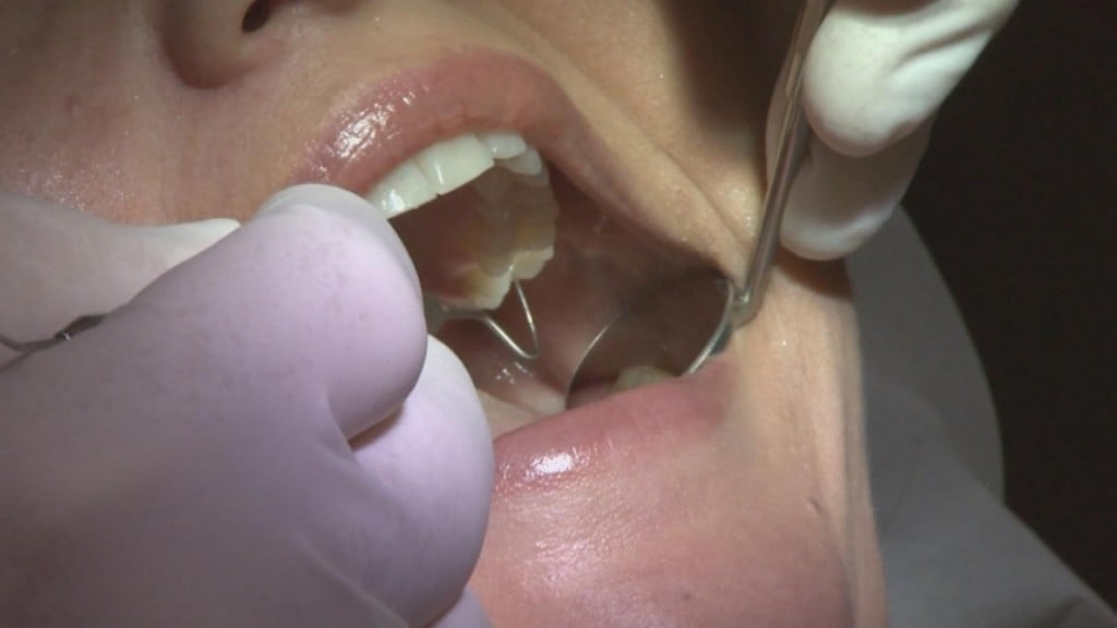 Nc Dentalcharges0506 1920x1080