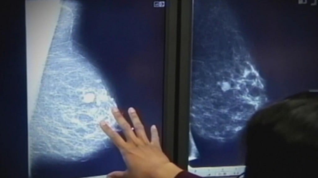 Breast Cancer Warning: Danger At Any Age