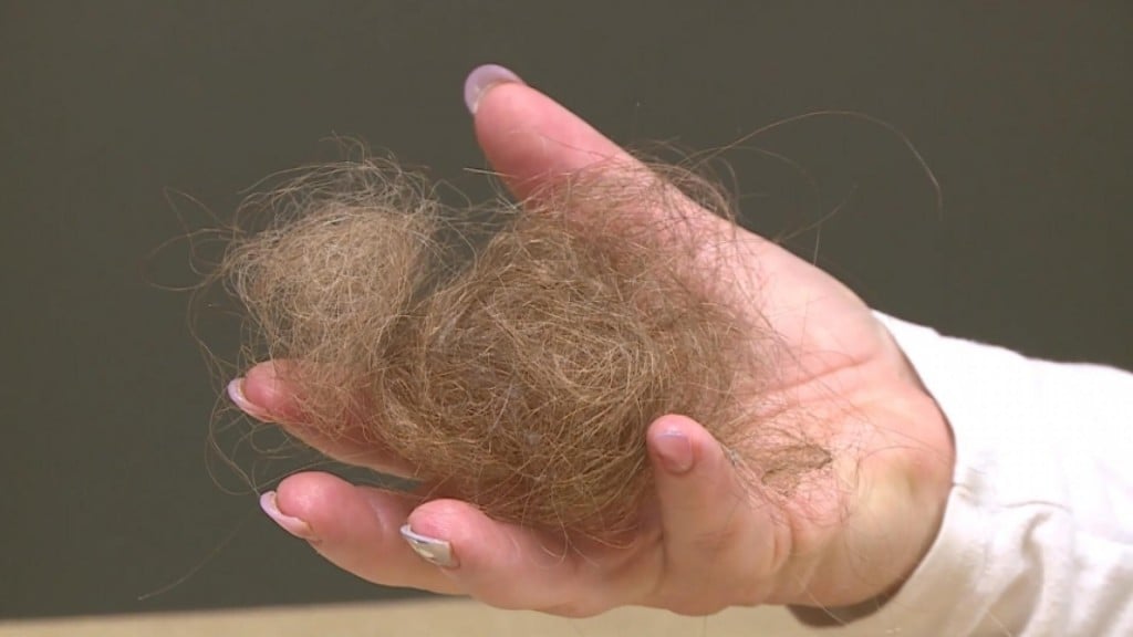 Explaining Covid 19 Hair Loss