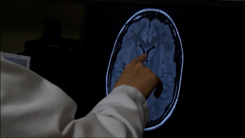 Brain Injury
