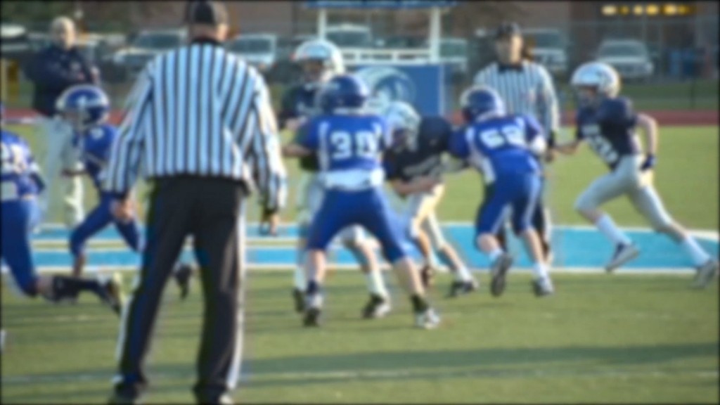 Concussion