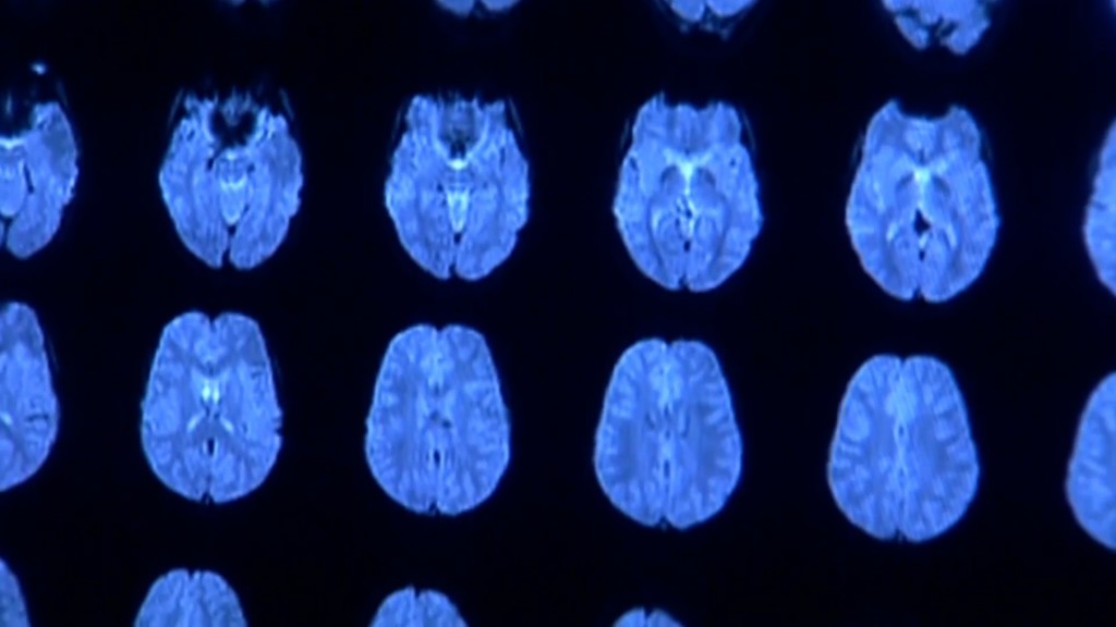 Concussion Sot00 00 18 02still001
