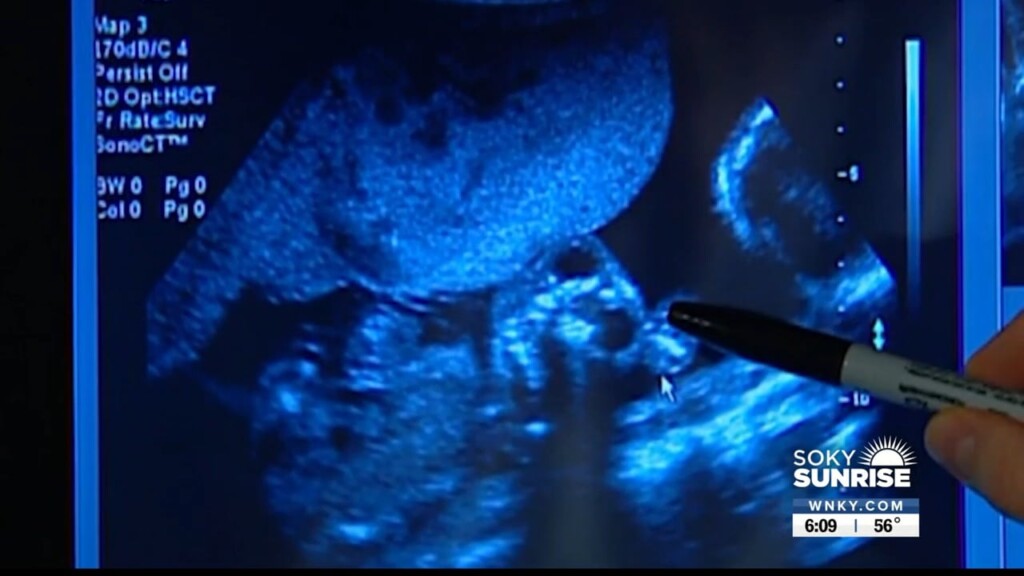 Living Well, New Study Reveals Pregnancy Covid Dangers. 011923