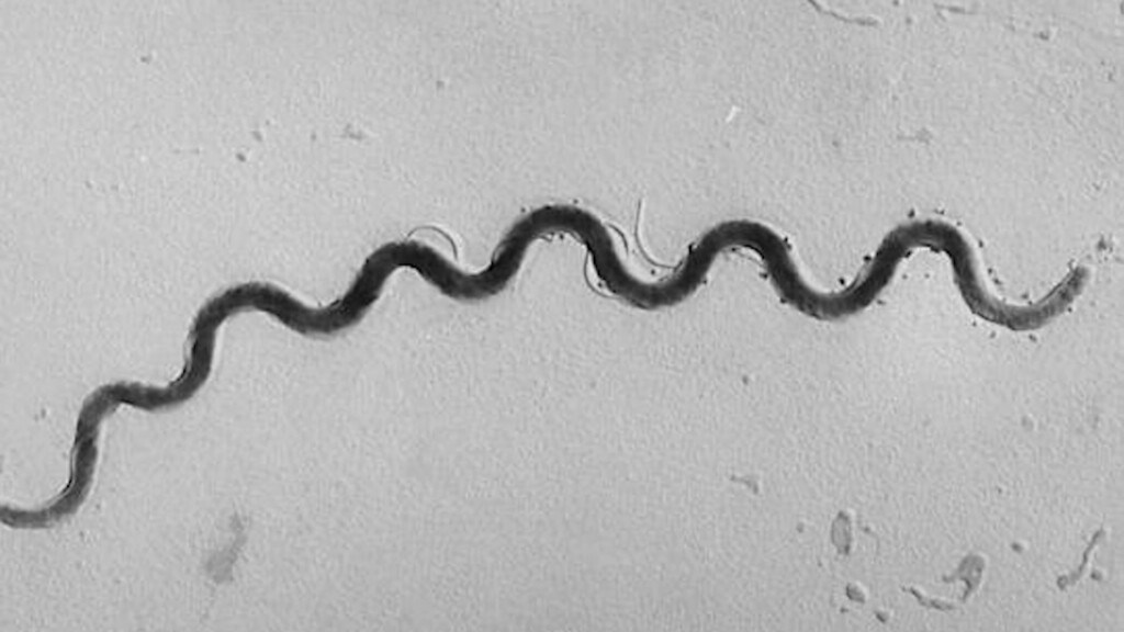 Syphilisontherise Vo00 00 04 07still001