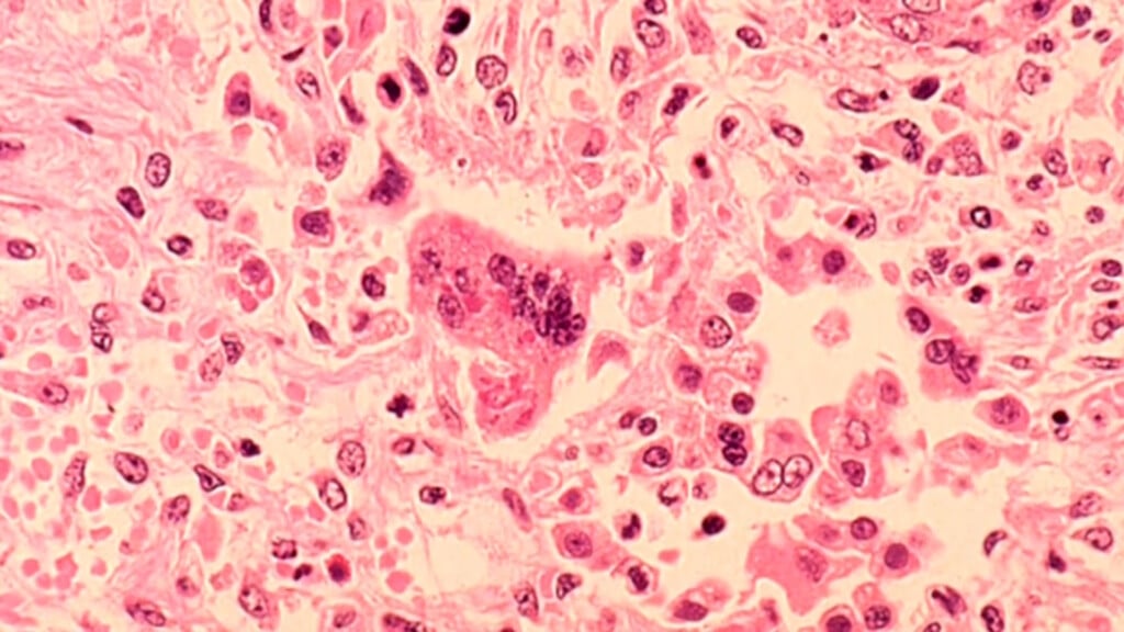 Measlesky Vo00 01 18 40still001