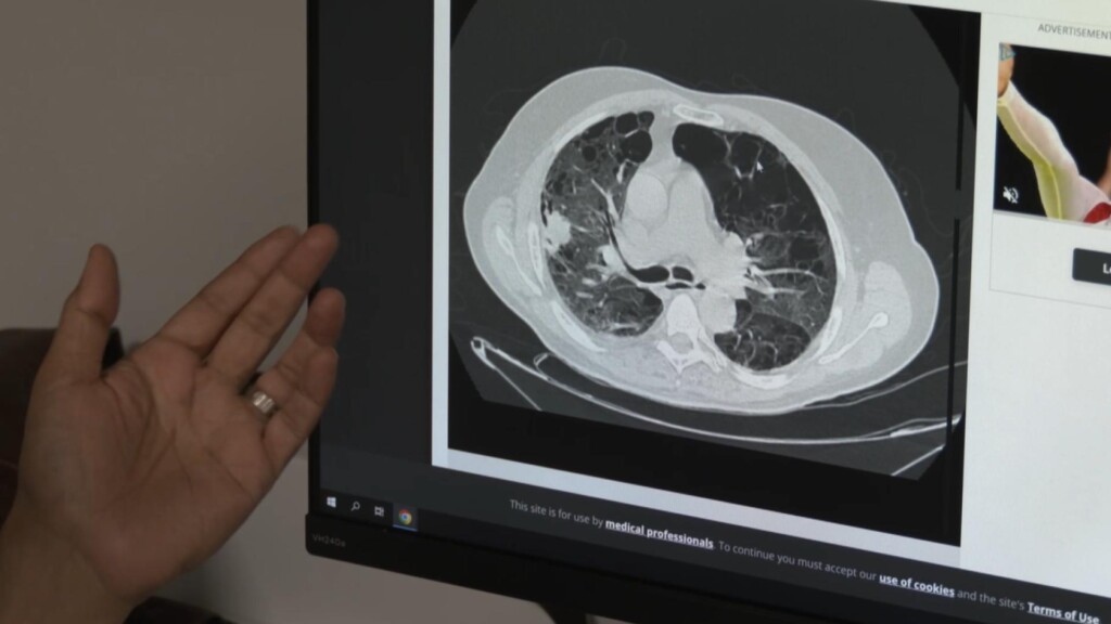 Photo Resize 2024 08 02t155000581