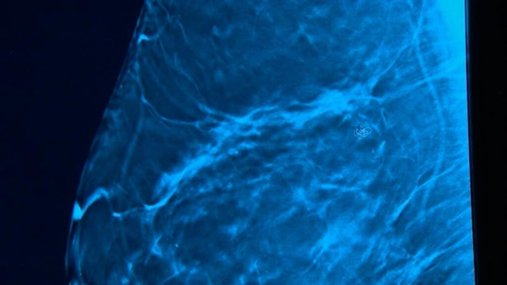 Photo Resize 2025 08 18t170449190
