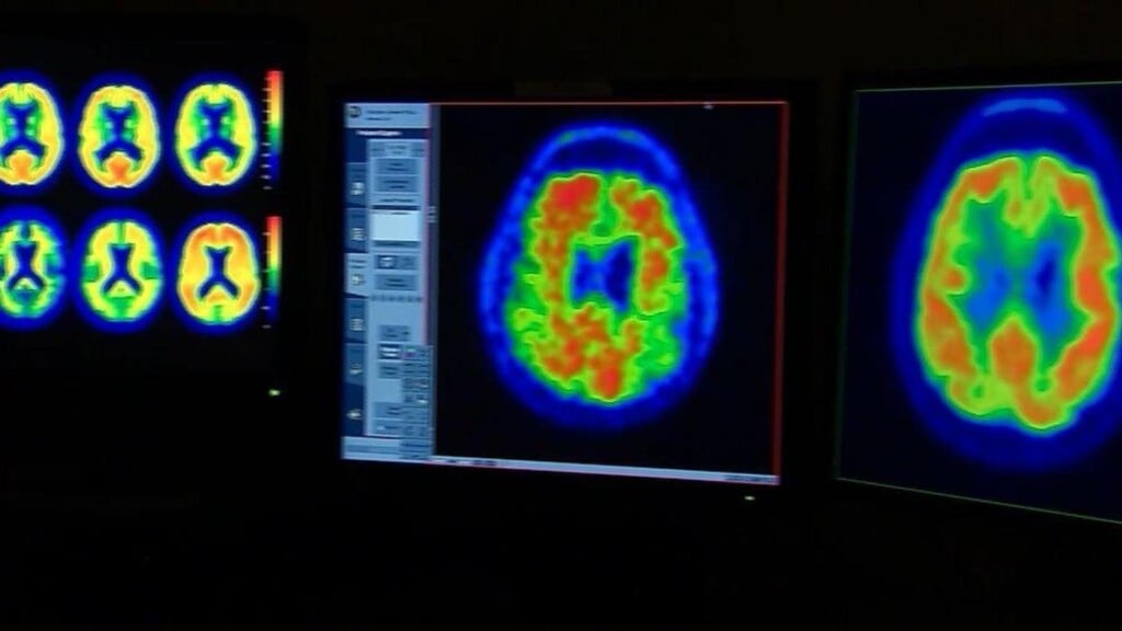 Photo Resize 2025 10 30t151757976