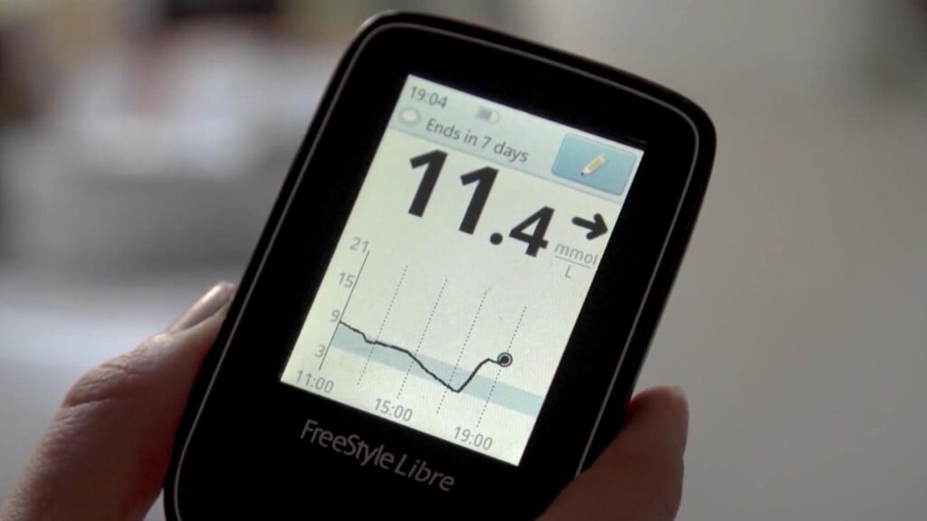 Photo Resize 2025 11 19t164638004