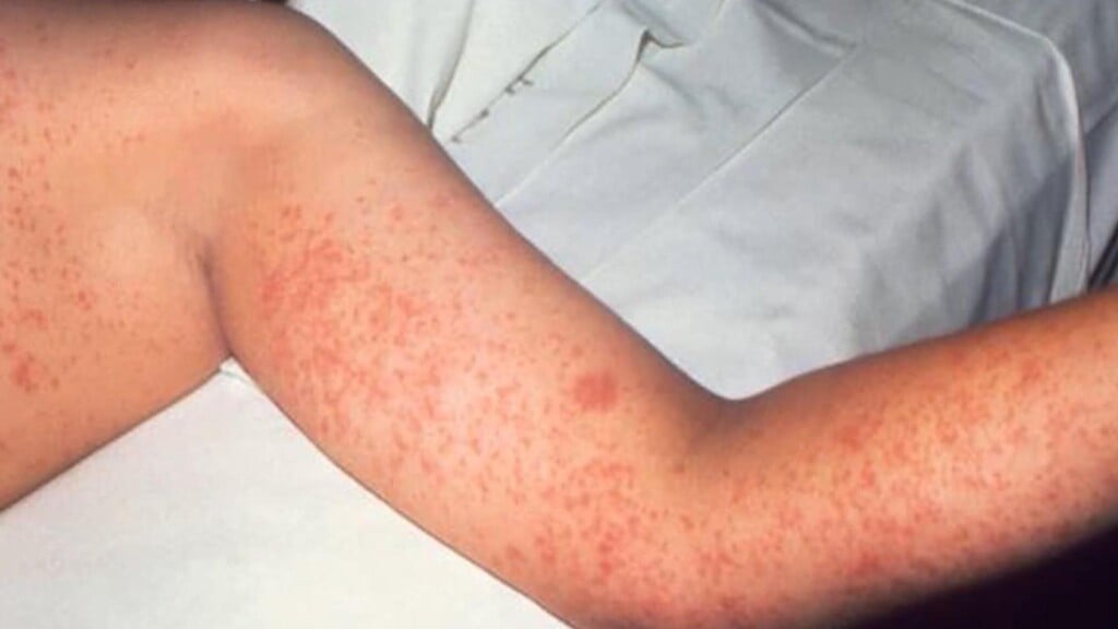 Photo Resize 2026 02 06t155533103