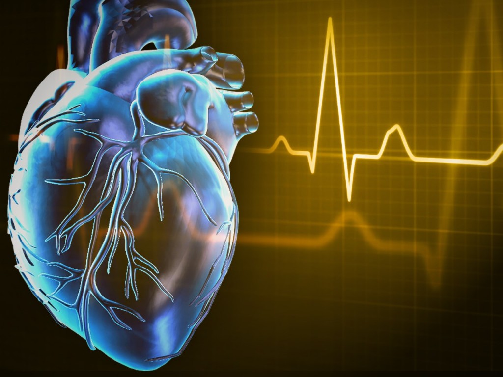 Cardiac Arrest