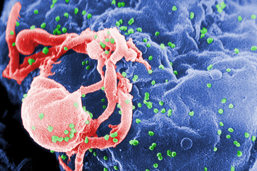 This undated photo provided by the Centers for Disease Control and Prevention shows a scanning electron micrograph of multiple round bumps of the HIV-1 virus on a cell surface. In a report released on Monday