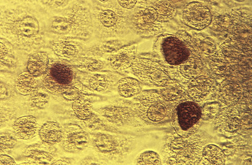 This 1975 microscope image made available by the the Centers for Disease Control and Prevention shows Chlamydia trachomatis bacteria magnified 200X. A report by the CDC released on Wednesday