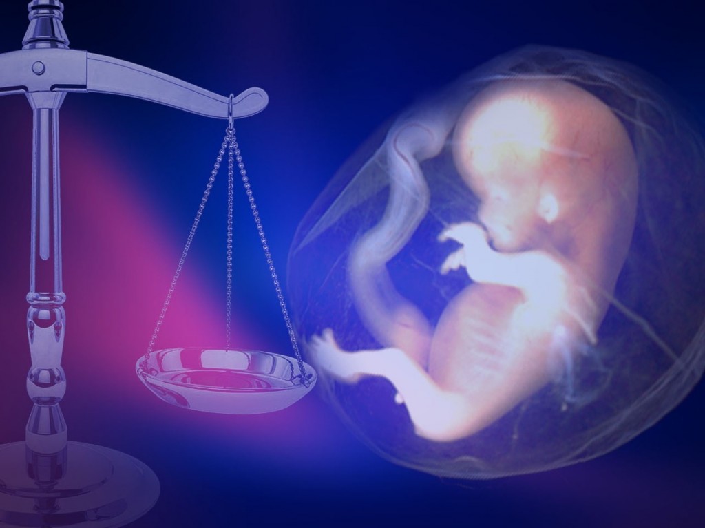 Abortion