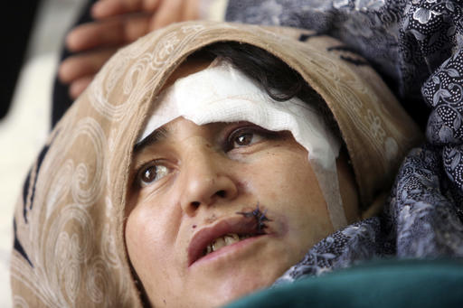 An Afghan wounded woman receives a treatment after a militant attack on a Shiite shrine in Kabul