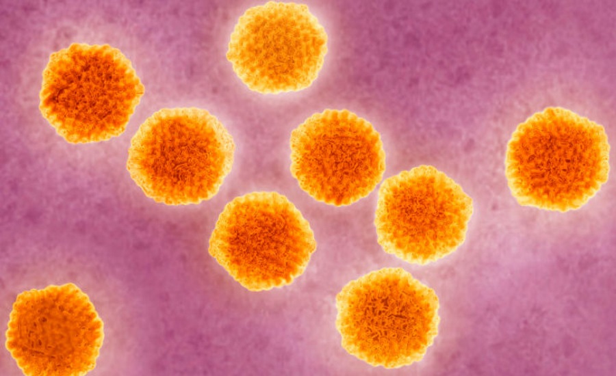 hepatitis A