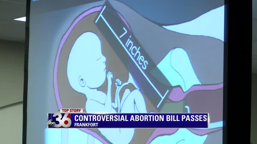abortion