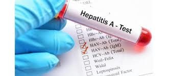 Hepatitis A test tube graphic - generic