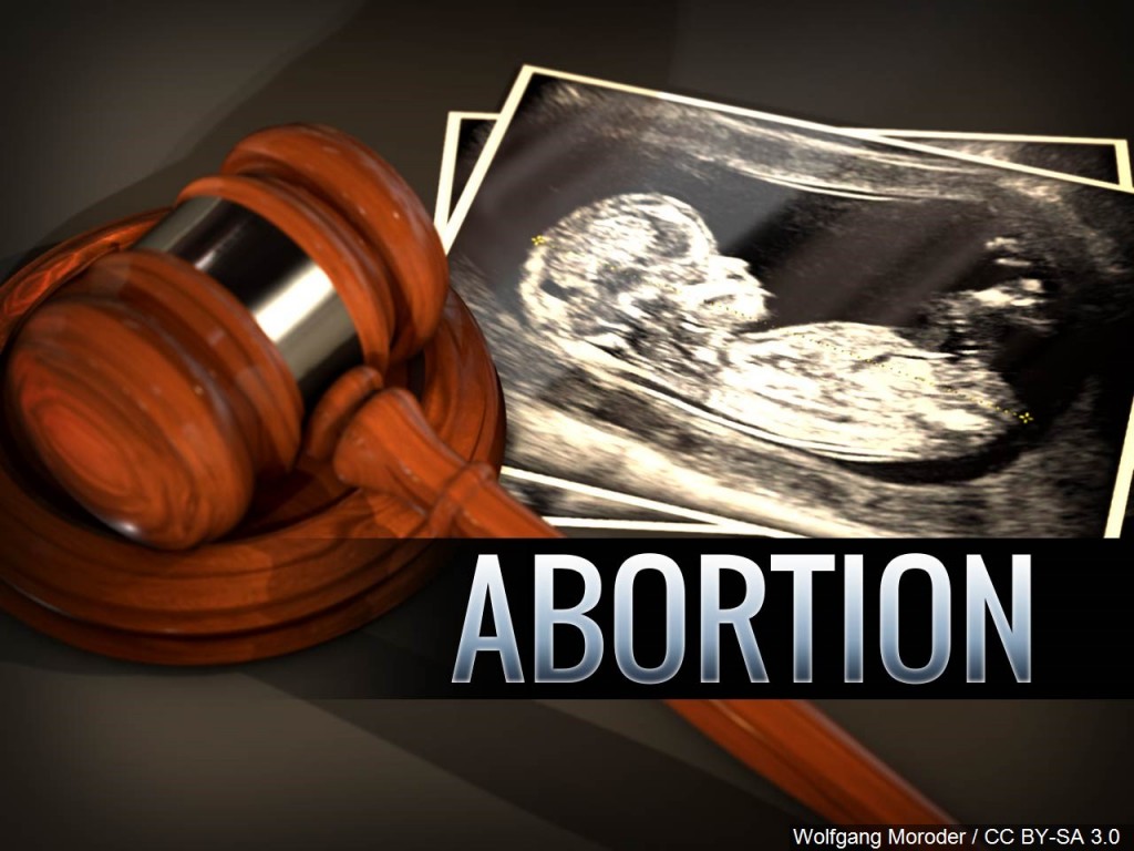 Abortion