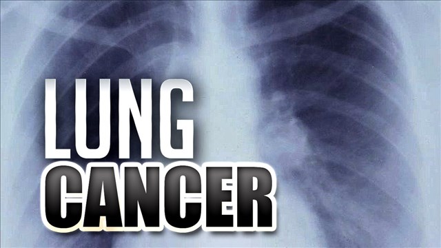 Lung Cancer