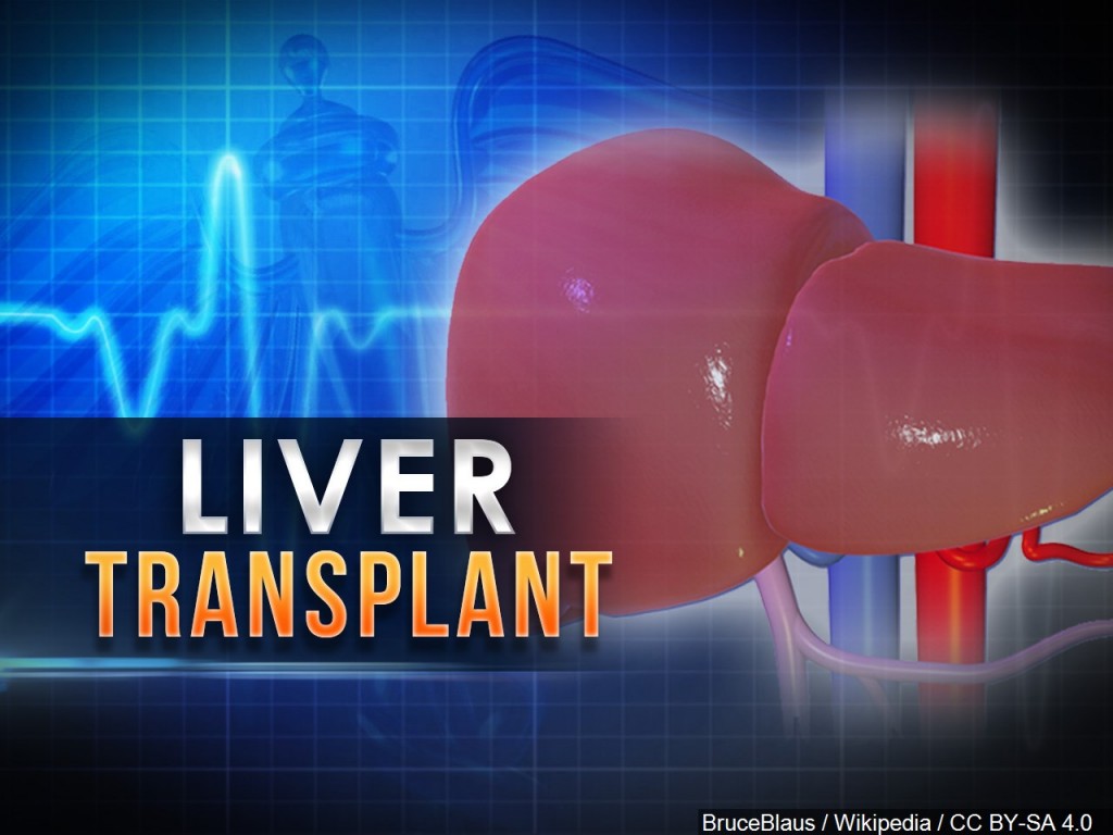 Liver Transplant