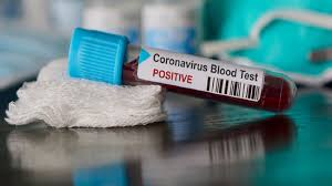 Coronavirus test positive tube (generic)