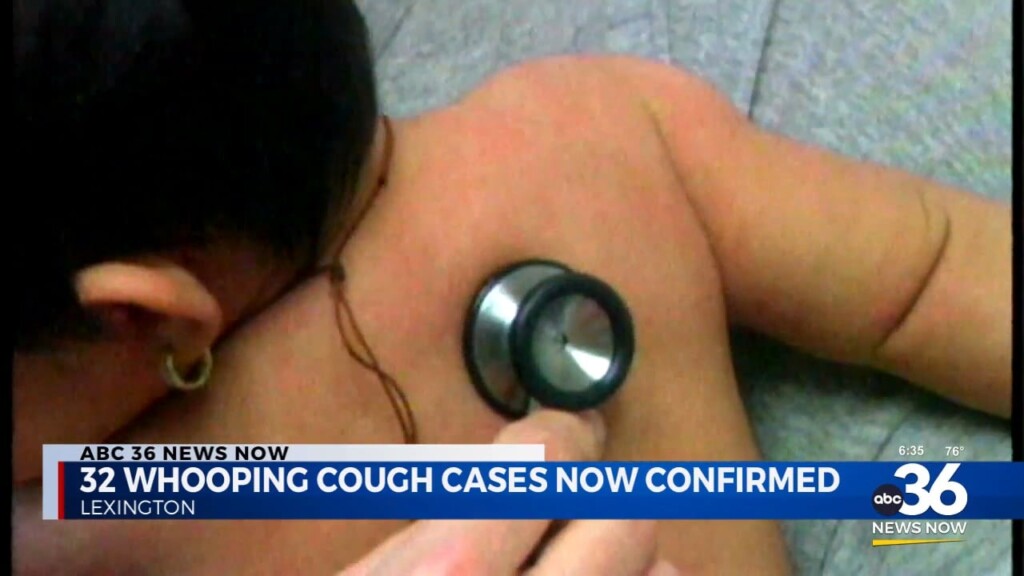 32 Whooping Cough Cases Now Confirmed