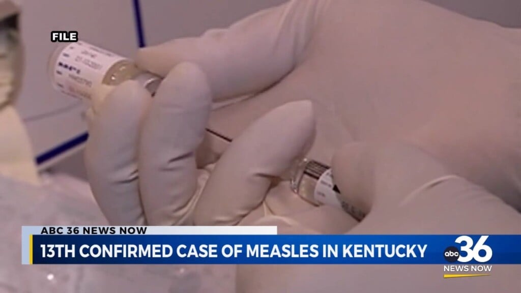 13th Confirmed Case Of Measles In Kentucky