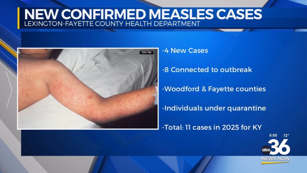 Fayette County Health Officials Confirm 4 New Measles Cases