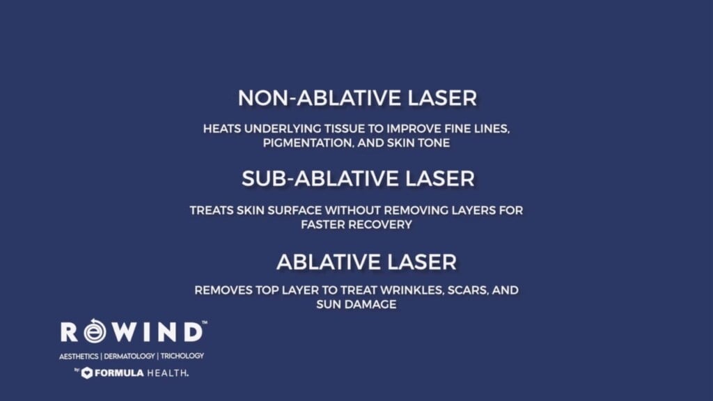 Ask The Expert: Rewind Aesthetics' Nouvaderm Technology