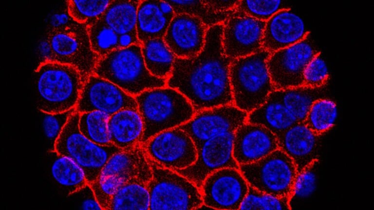 Photo by: Min Yu/USC via NIH via AP