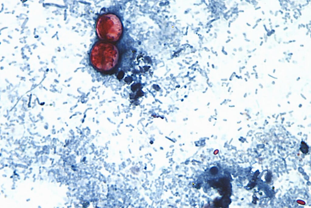 Cyclospora Outbreak History