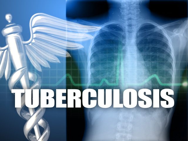 Tuberculosis South Carolina school