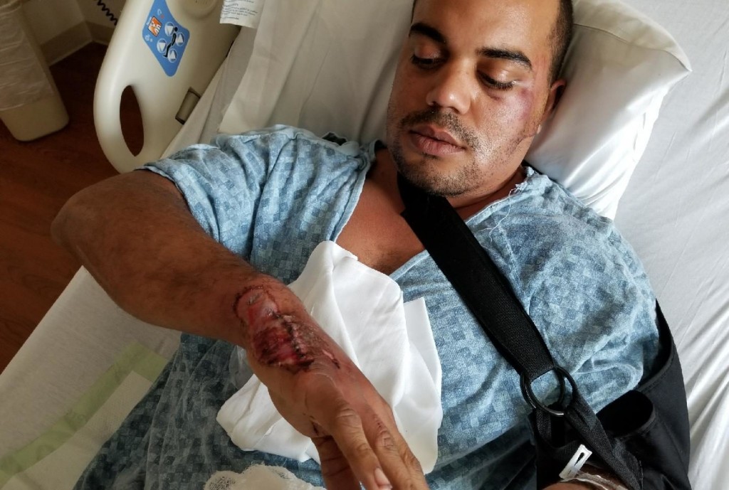 Vincent Iventosch was admitted into the hospital after the accident and has steadily recovered since then.