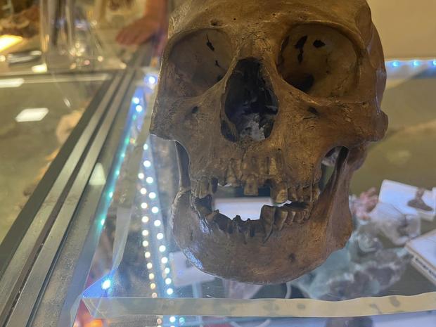 Skull