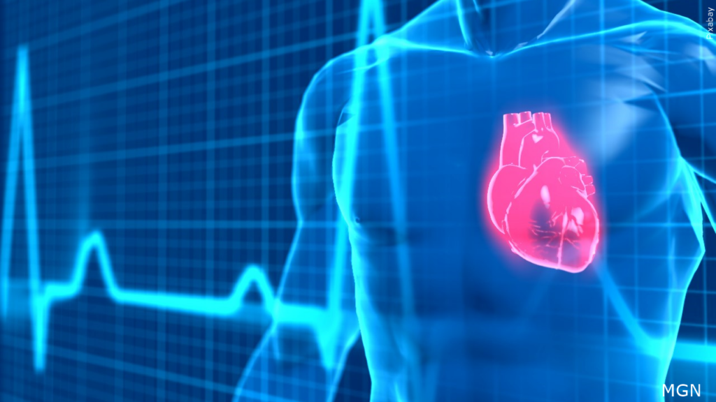 Cardiac Graphic
