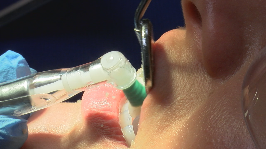 Over the past few weeks, the Rotary Club has organized three free dental clinics for children at St. Mary Health Center. (Photo:Nate Mauldin/WWAY)