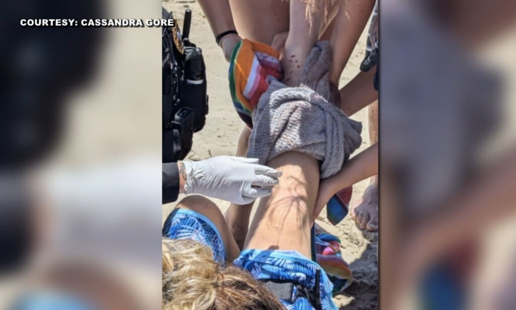 Shark Bite
