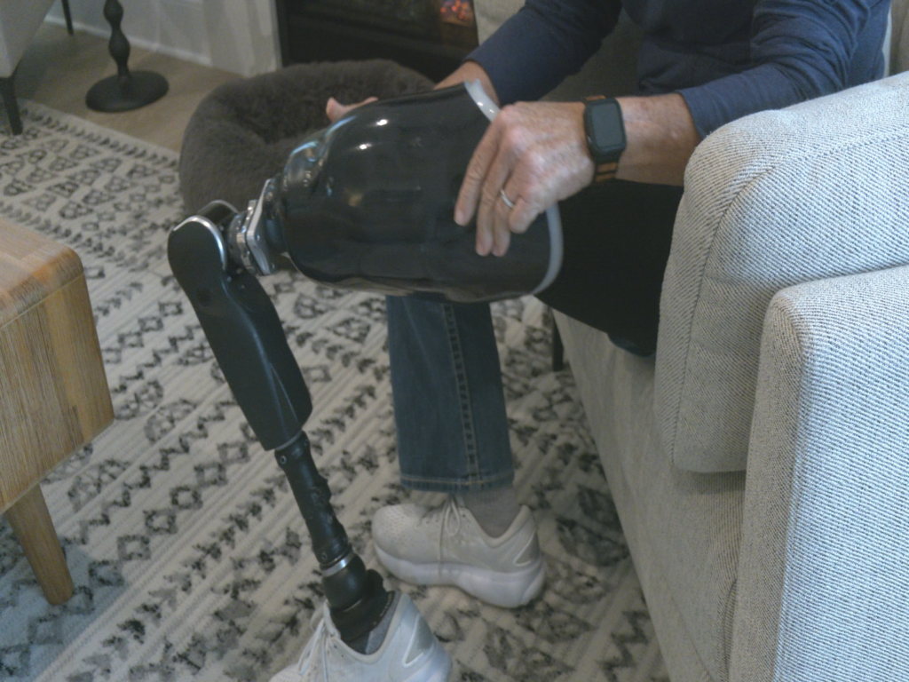 Tracy Turner putting on her prosthetic leg