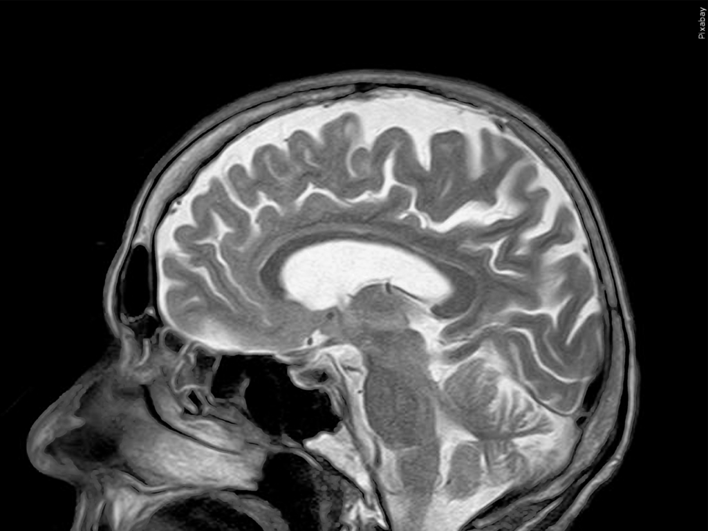 Mgn 1280x960 80321p00 Gbnnr