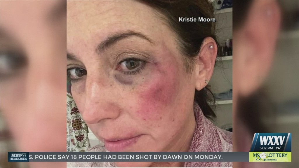 Laurel Mother Arrested And Charged After Allegedly Punching Umpire