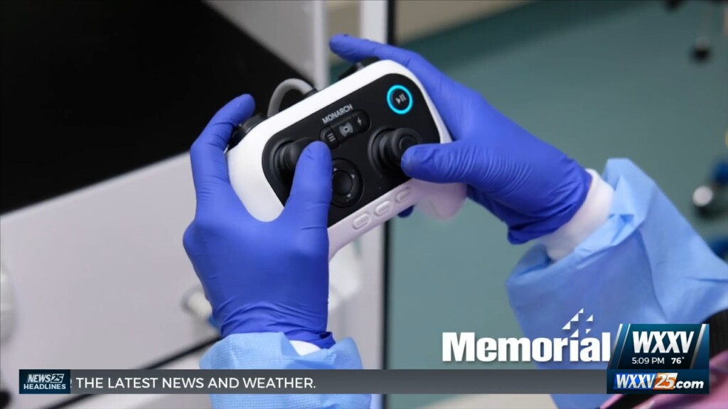 Memorial Health System Celebrates Completing 400 Robotic Bronchoscopy Cases