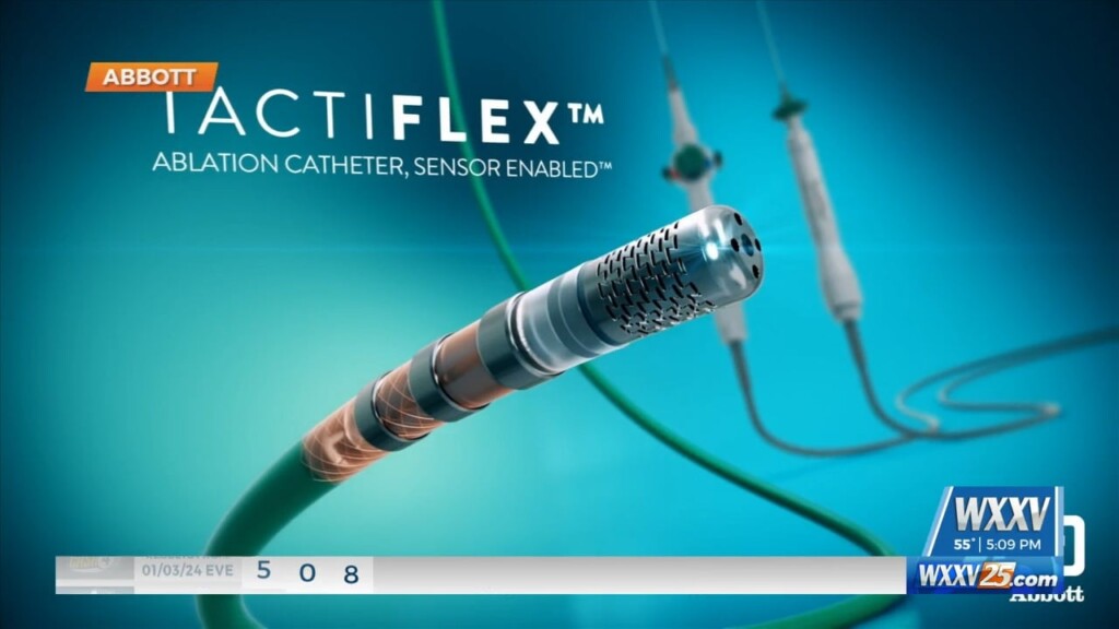 New Tech To Treat Heart Arrhythmias At Memorial Hospital