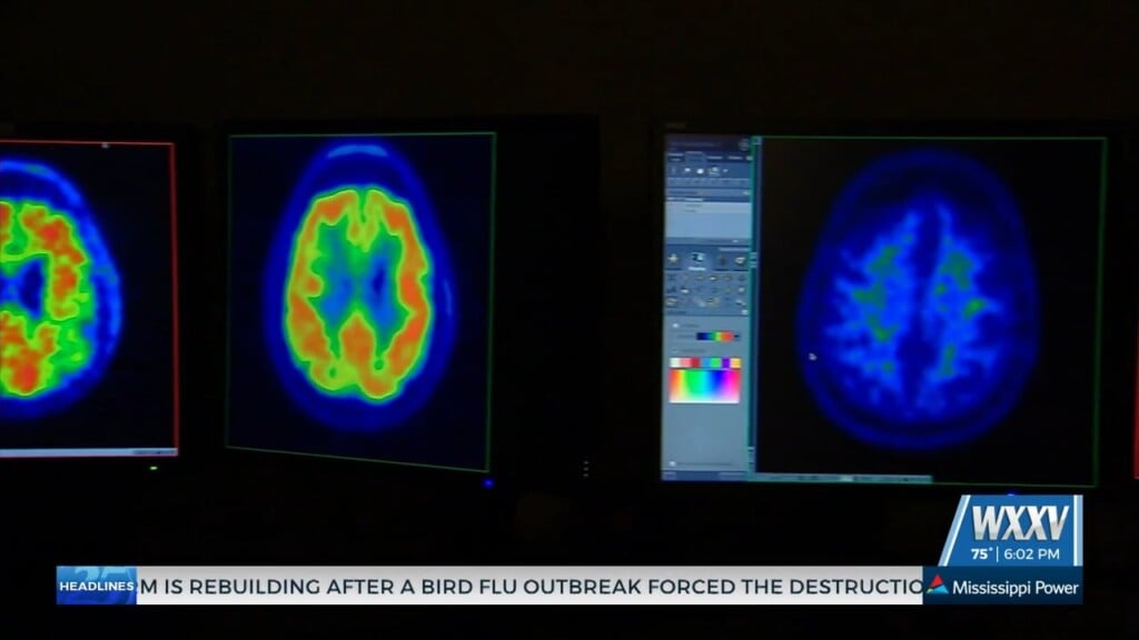 Alzheimer's Awareness Month: Sit Down With Dr. Lee Voulters Of Memorial Health System