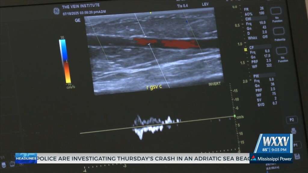 South Mississippi Vascular Surgeon Discusses Chronic Venous Insufficiency Following Trump's Diagnosis